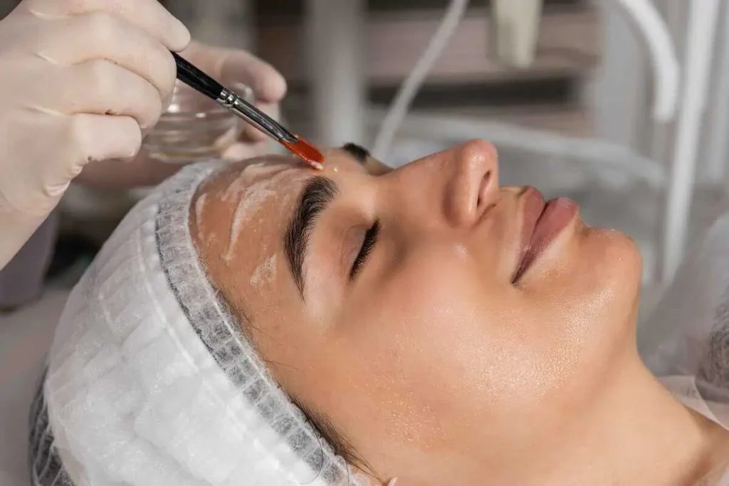 CHEMICAL PEELS-Luxe Lab Aesthetics and Wellness