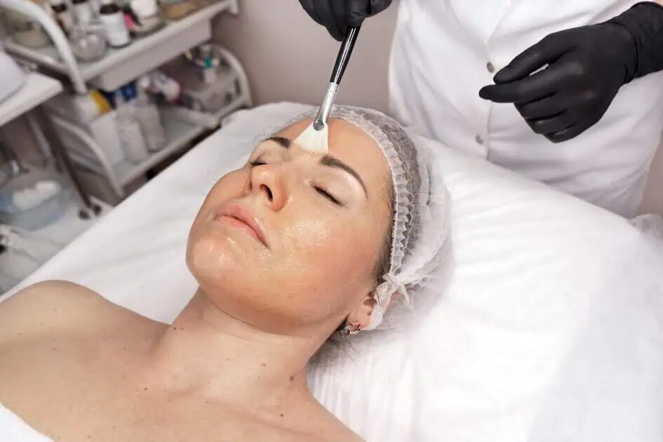 Chemical Peels in Palm Beach Gardens, FL | Luxe Lab Medspa